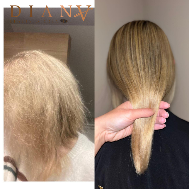 PreNano HaarBotox – Intensive Repair & Deep Nourishment Treatment 1000ml