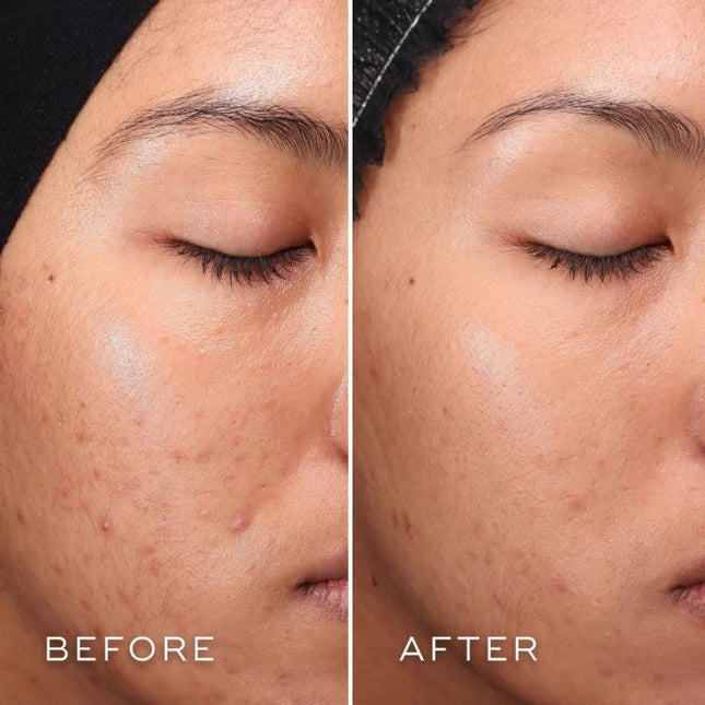 Medik8 Press &amp; Clear Cleanser 150ml